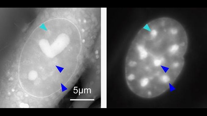 Новий тип мікроскопа дозволив розглянути хромосомну "темну матерію" всередині живих клітин