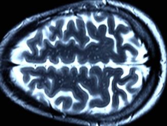 Вчені приховали смерть пацієнта з «жвавим» мозком
